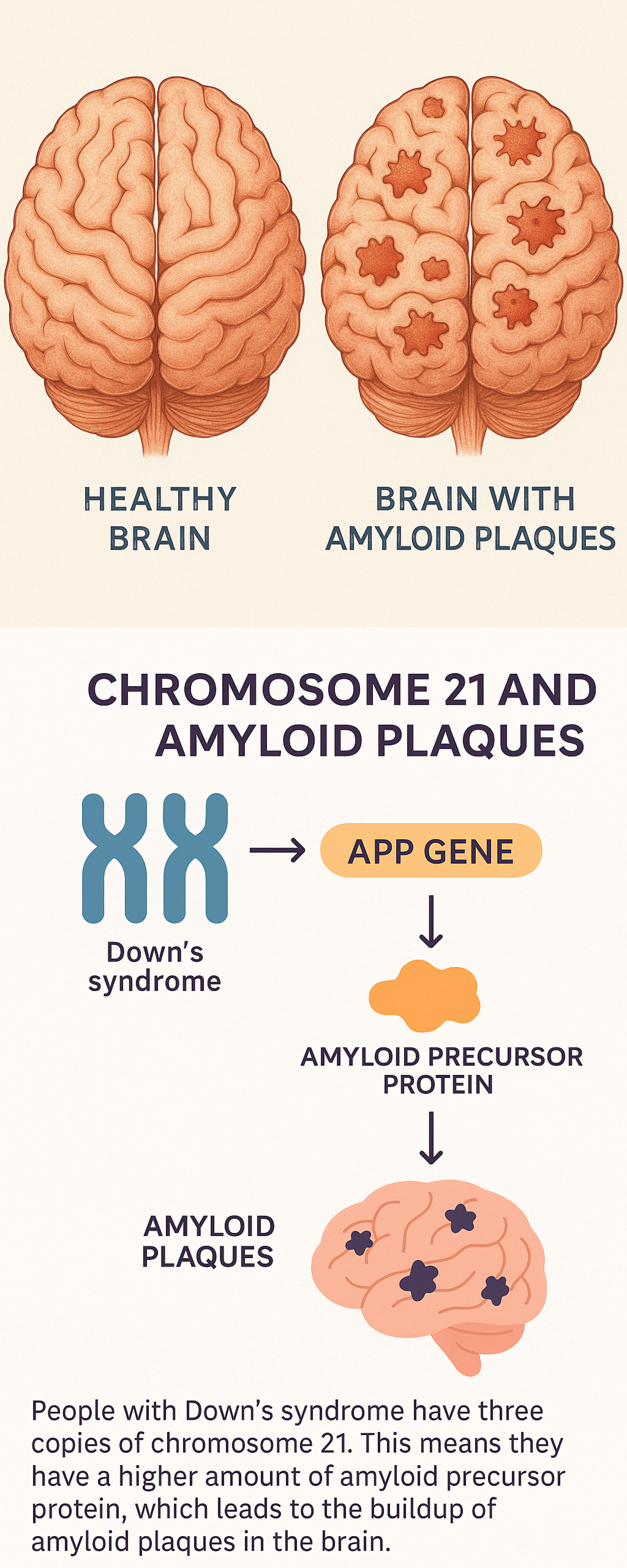 Combined Dementia Plaques And Chromosome 21 Info